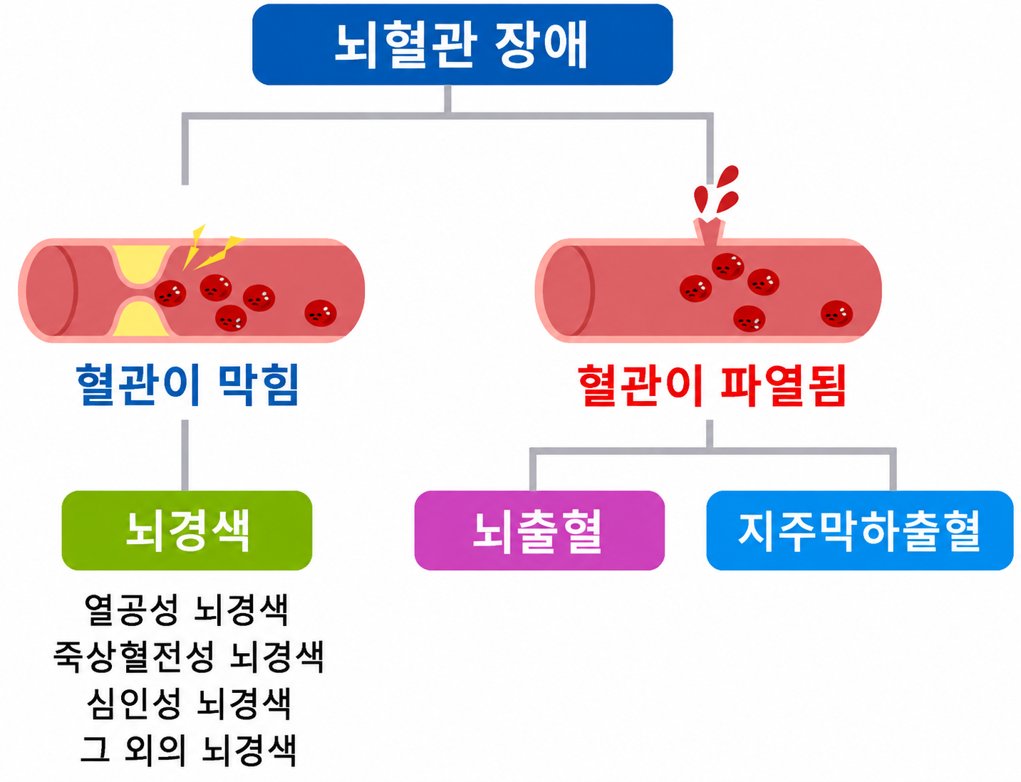 뇌혈관 장애의 종류: 뇌경색, 뇌출혈, 지주막하출혈