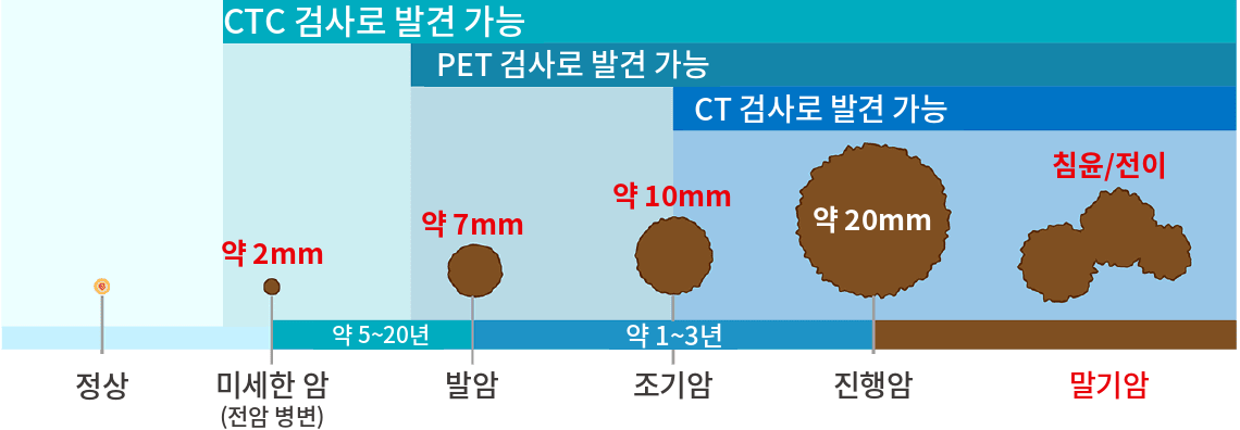 암의 크기와 검사별 발견 가능 시기